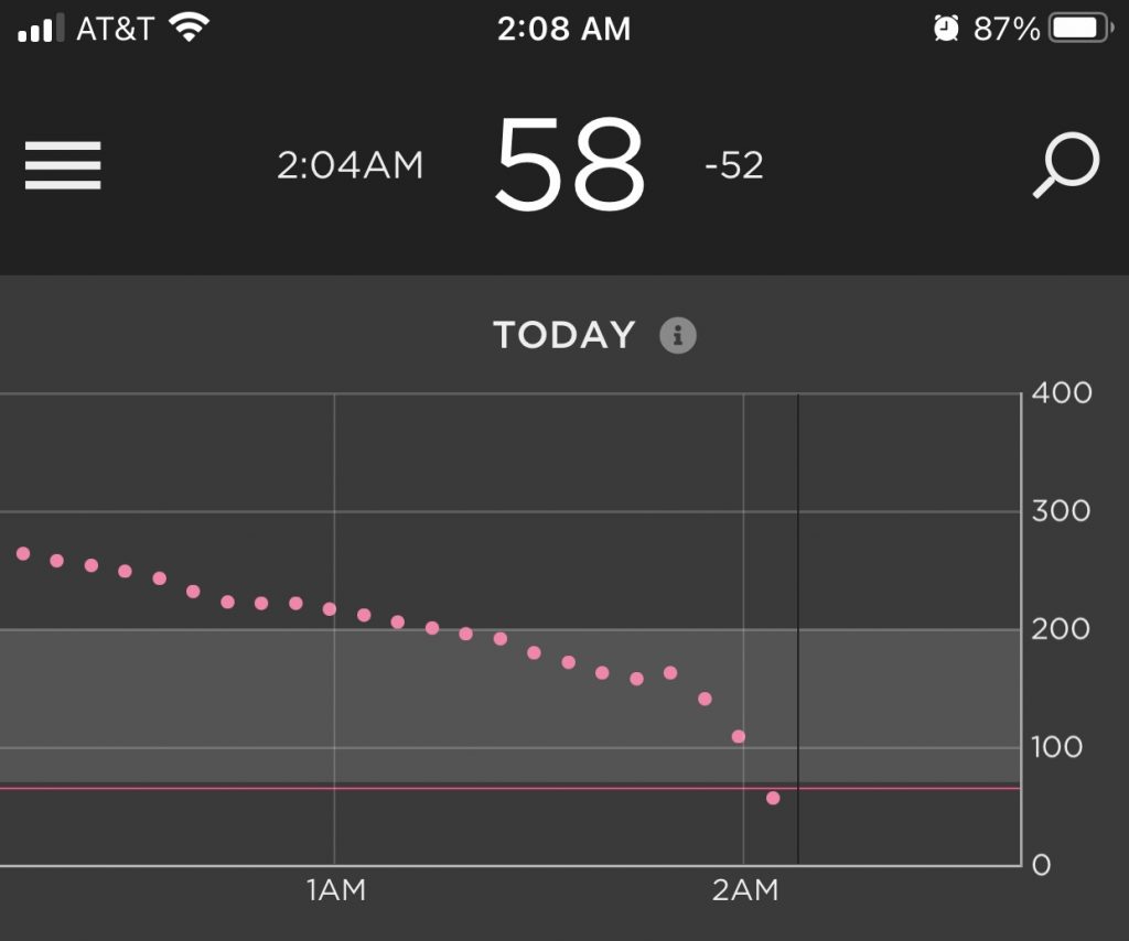 Dexcom Sugarmate Image of a compression low (false low)