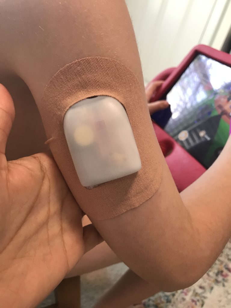 Omnipod with patch on image